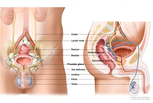 Prostate Surgery