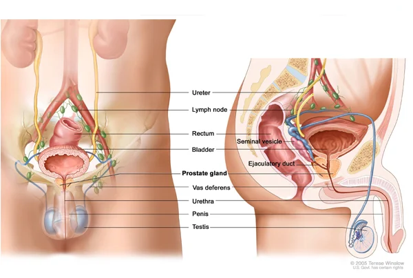 Prostate Surgery